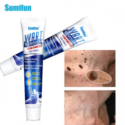 Wart remover ointment