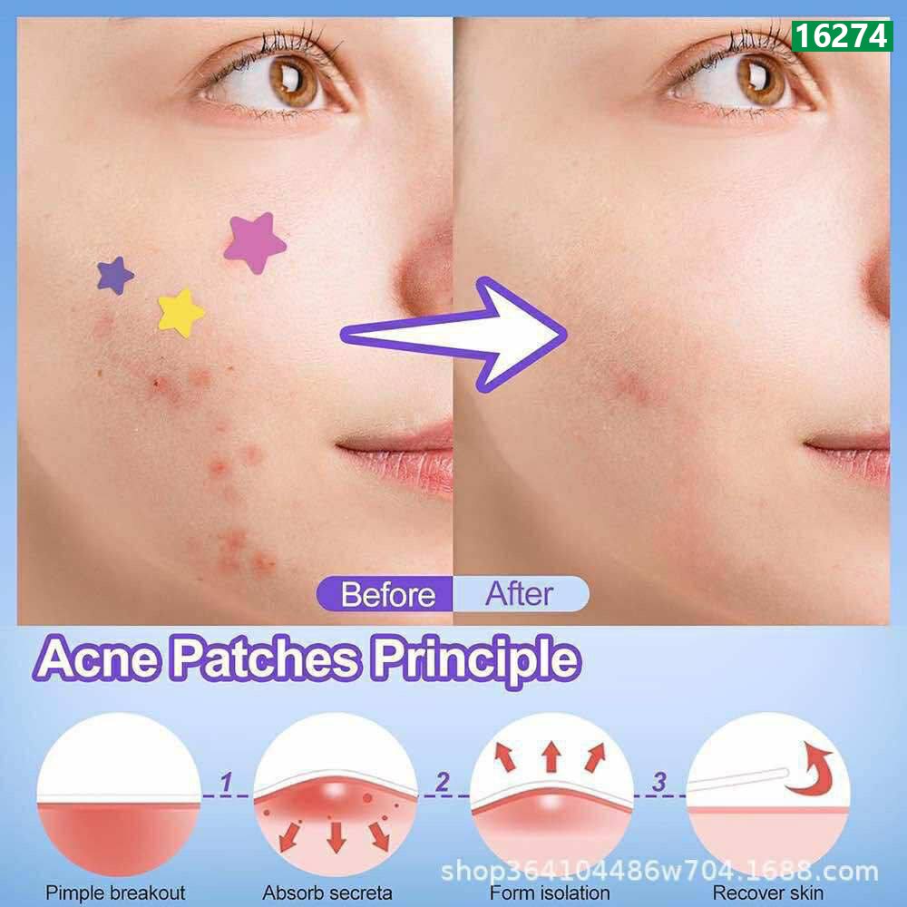 Colorful Acne Patches Set